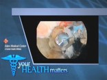 Eden Medical - Cancer Segment 1