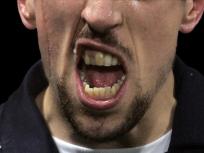 Campbell Wants to Fix San Jose's Teeth