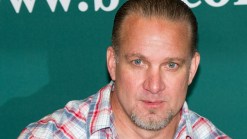 Jesse James Severs Fingertip, Instagrams Graphic Pictures