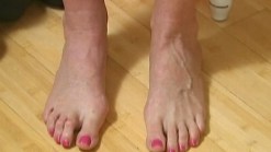 Treating Pain in the Foot