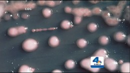Superbug Infections Prompt Health Warnings