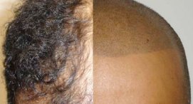 Hair Tattoos