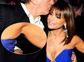 Eww! Celebrities: Paula Abdul