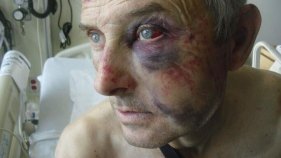 Berkeley Man Nearly Beaten to Death by CHP