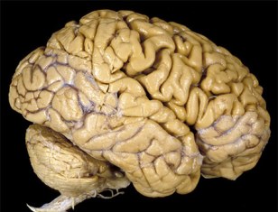 Intel Researching Channel Surfing With Your Brain