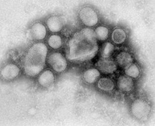 Rare Resistant Swine Flu Comes to SF
