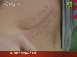 Boy Sells Kidney for iPad 2