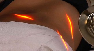 Zapping the Fat Away