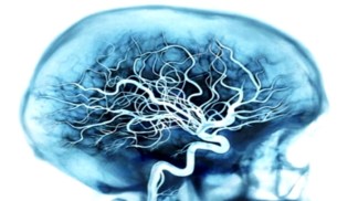 7 Things To Fight Alzheimer's Disease