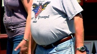 Obesity Battle Continues