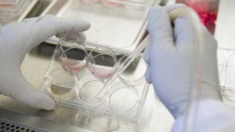 UCSF Prof. Named As Nobel Prize Recipient