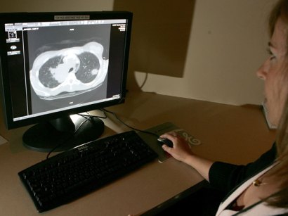lung CT scan