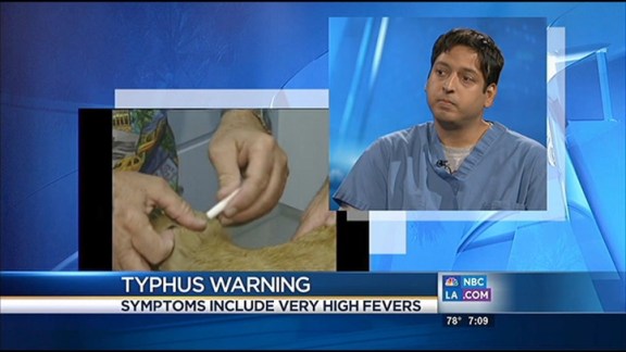 Typhus Warning: Dr. Sanjeev Seth Explains