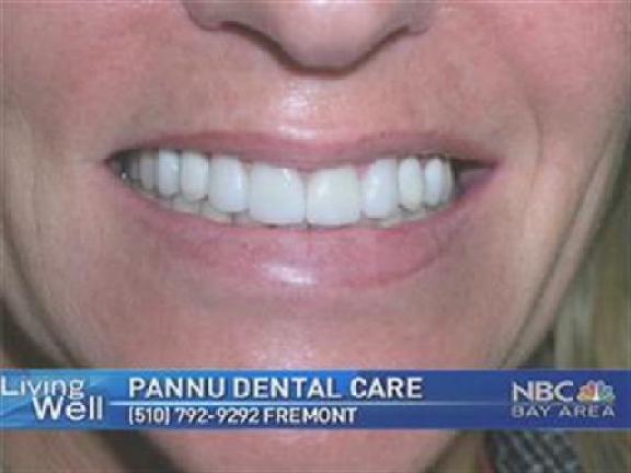 Dr. Pannu talks about Dental implants and has a great offer for <a title=