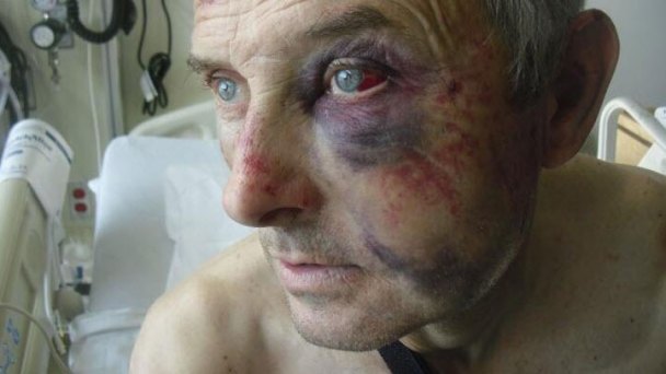 Berkeley Man Nearly Beaten to Death by CHP