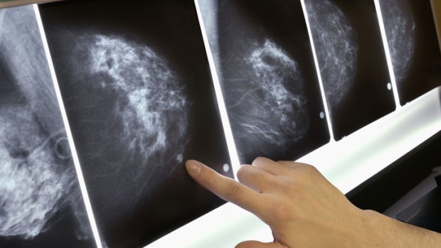 Shining a Brighter Light on Mammograms