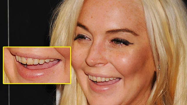 Eww! Celebrities
