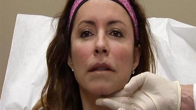 A patients own blood is used in a cosmetic procedure designed to make the face look younger.