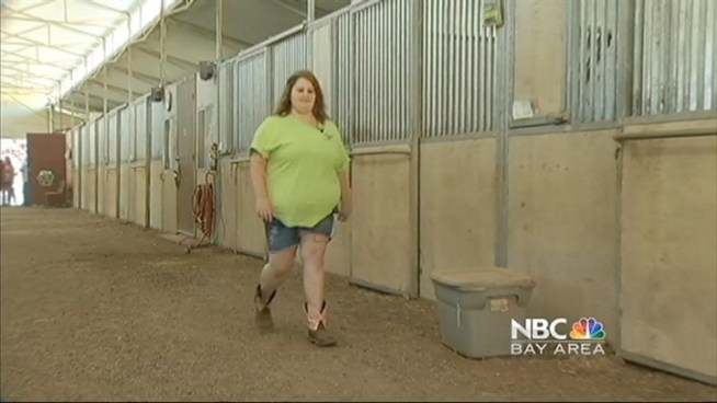 A Napa woman who was diagnosed with lupus when she was 12-years-old and subsequently suffered from drug-induced obesity underwent a life-saving gastric bypass surgery at Stanford Hospital & Clinics about a month ago.And Stanford is now using the case of Jena Graves as an example to warn others that sometimes taking steroids to cure one problem, may lead other problems that actually can be worse.