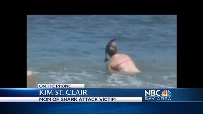 A 16-year-old girl from Livermore visiting Hawaii was attached by a shark Tuesday.