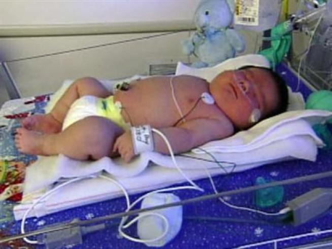 A 14-pound newborn is born in Southern California.