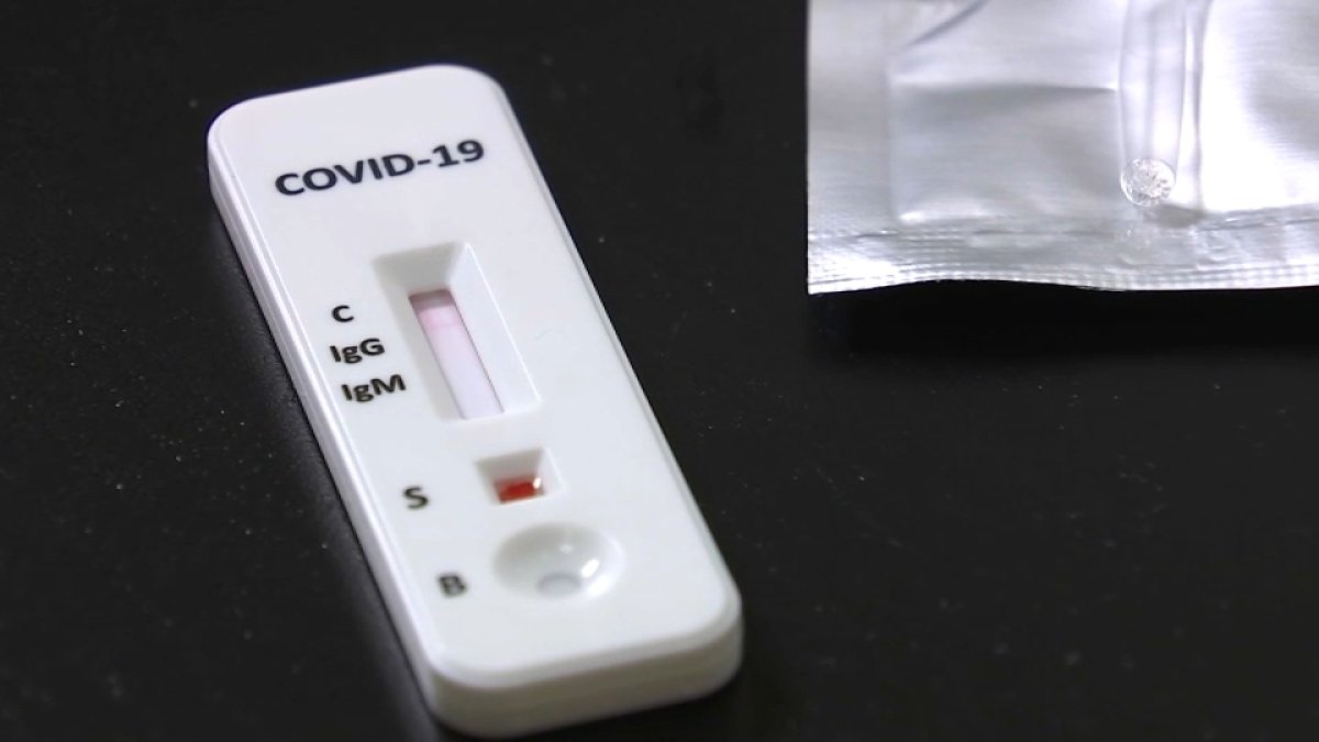 Bay Area Lab Offers COVID19 Immunity Tests NBC Bay Area