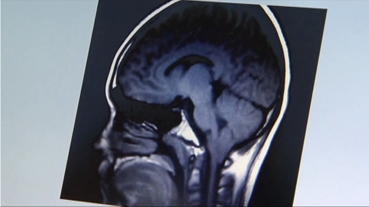 090411 brain image