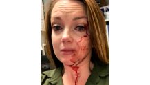 This May 6, 2020 selfie by Samantha Clarke shows her bruised and bloodied face after she was assaulted by a shopper at the retail store she manages in Modesto, Calif. Despite the abuse and occasional threats, Clarke says she never expected to be sucker-punched and knocked to the floor by an angry shopper as happened earlier this month. (Samantha Clarke via AP)