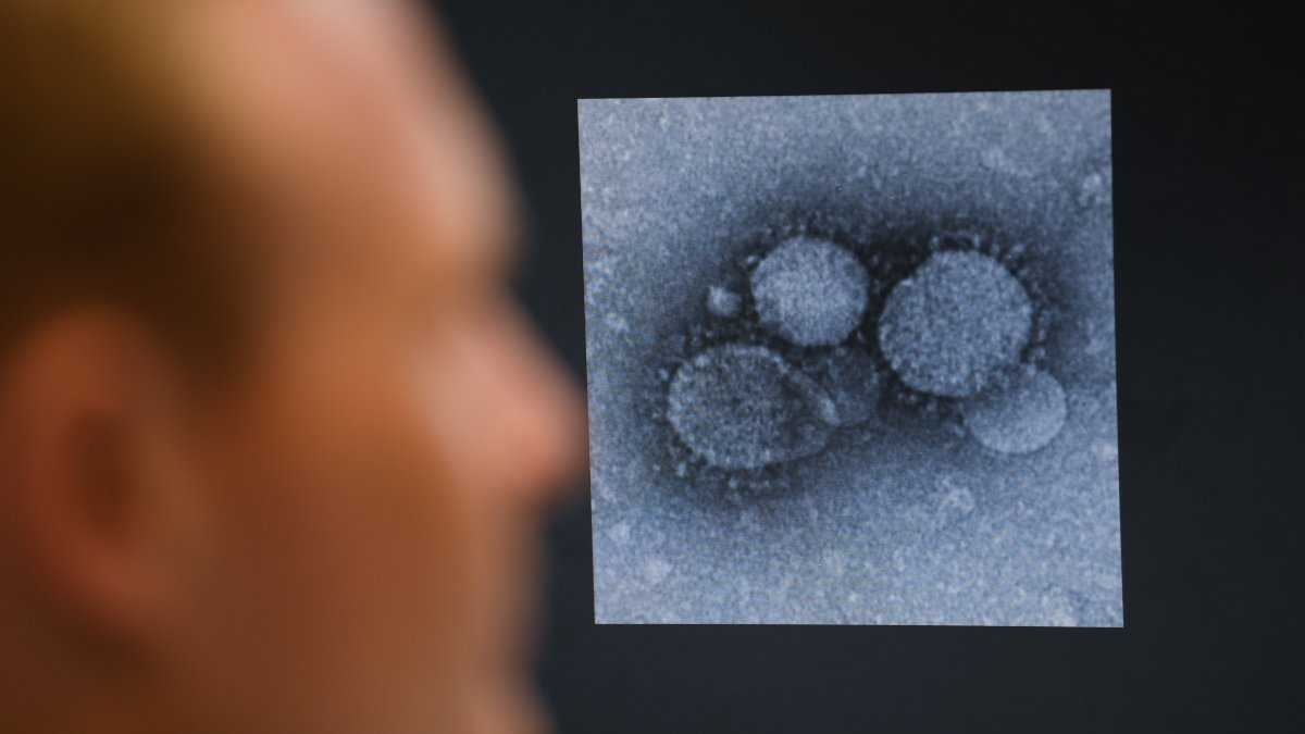 California’s First Case of Coronavirus Confirmed in Orange County NBC