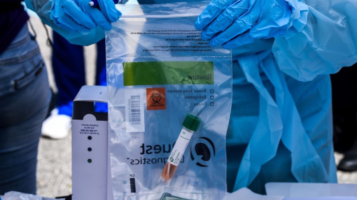 Hayward Opens Center Dedicated to Coronavirus Testing NBC Bay Area