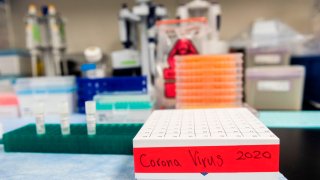 Three potential coronavirus, COVID-19, vaccines are kept in a tray; lab equipment is in the background