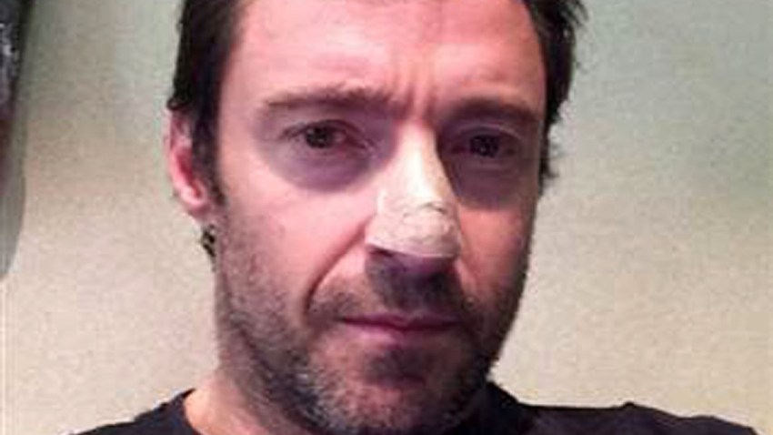 Jackman skin cancer