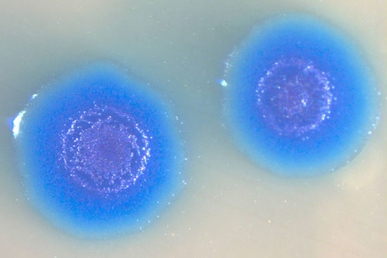 Mycoplasma_genitalium-thumb-550xauto-96510