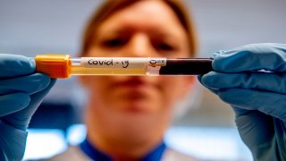 A lab technician holding a test tube that contains blood sample from a patient that has tested positive with the COVID-19 coronavirus at Amphia Hospital