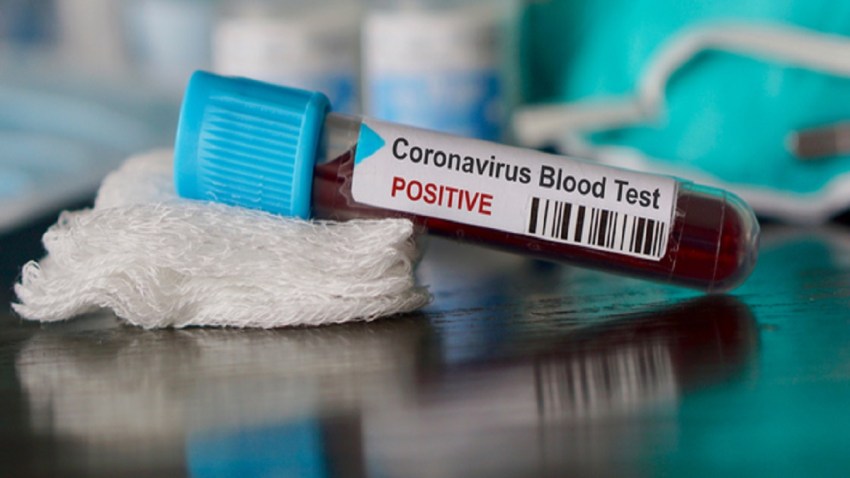 Coronavirus Update Who Team Visits China As Death Toll Jumps To 2 442