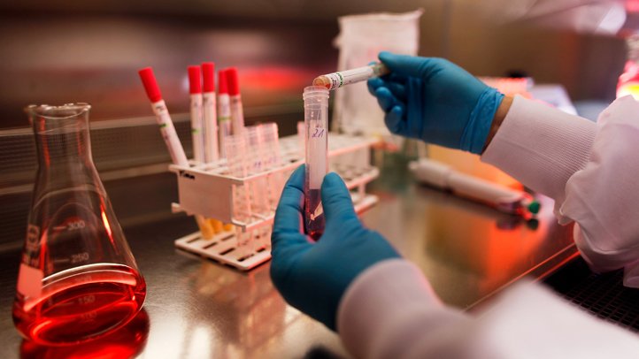 UCSF Scientists Look Into How Omicron Variant Got to the Bay Area - Vimarsana News