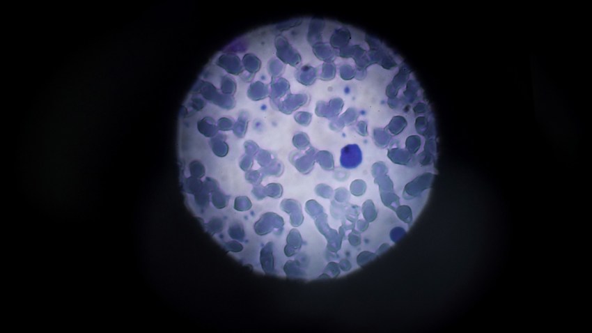 AA_02022016_207417