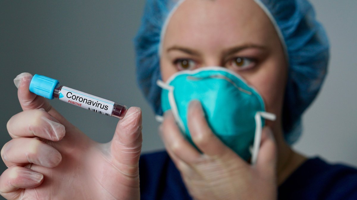 COVID19 Variant Linked to Outbreaks in Santa Clara County, Including