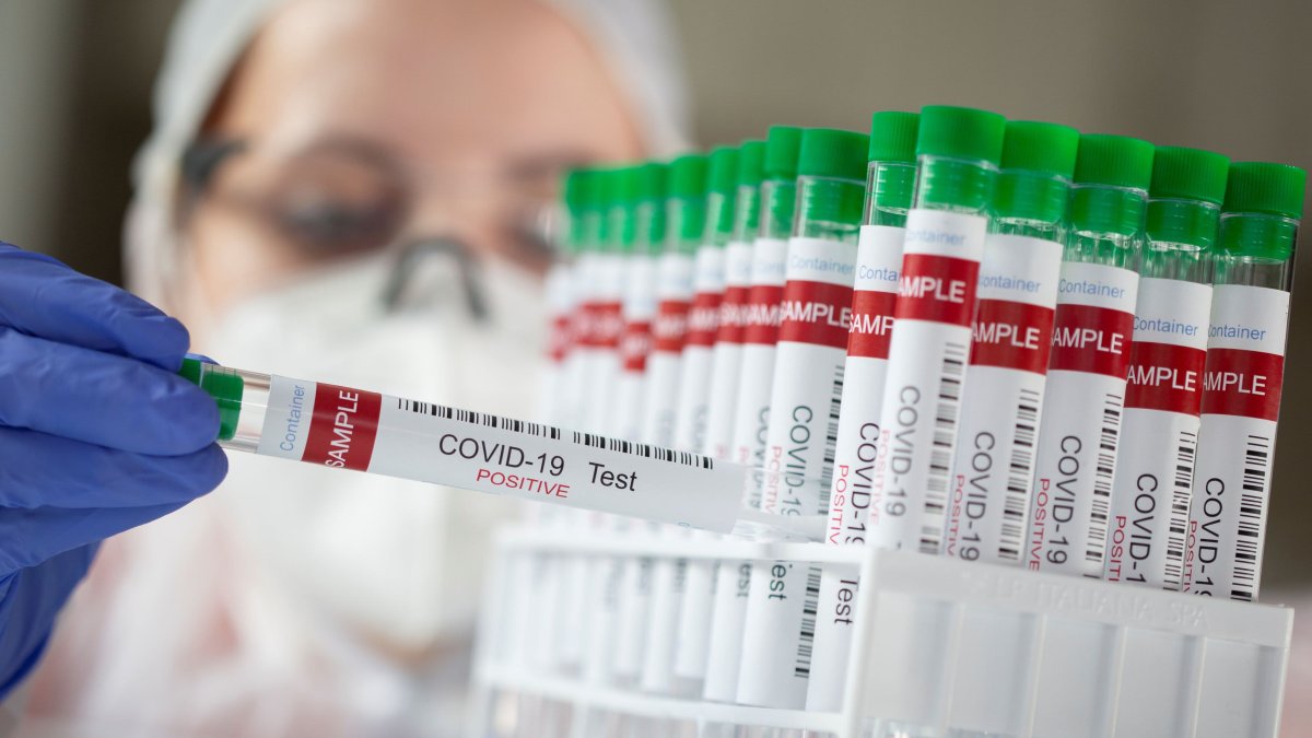 Santa Clara County Reports 2nd Case of COVID19 Variant First