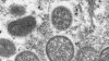 Sacramento Public Health Officials Investigate Potential Case of Monkeypox