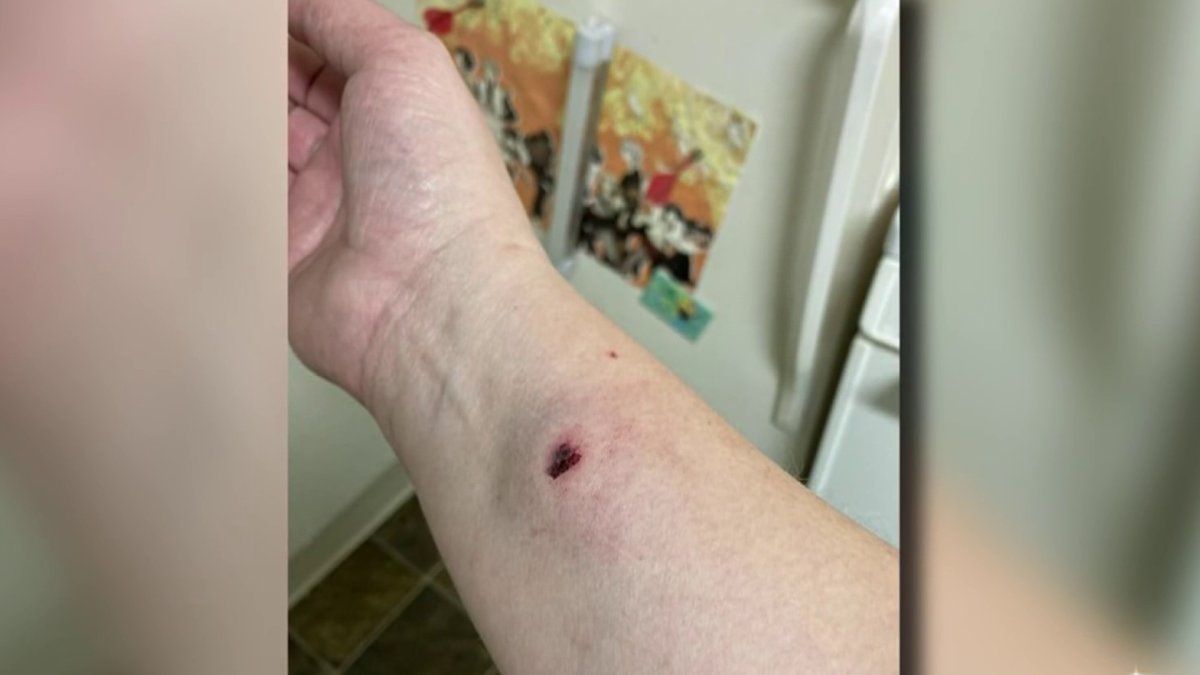 San Jose Police Investigate Pellet Gun Attacks NBC Bay Area