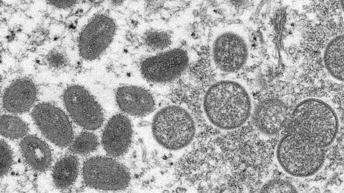 Activists Plan to Rally for More Action on Monkeypox in San Francisco - Vimarsana News