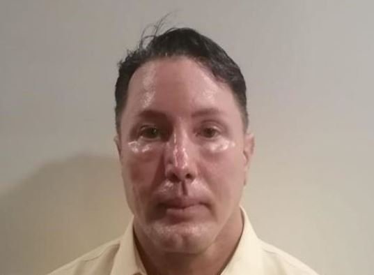 Master of Disguise: Fugitive Altered Face With Plastic Surgery Before Girlfriend Found in Trunk in Tijuana - Vimarsana News