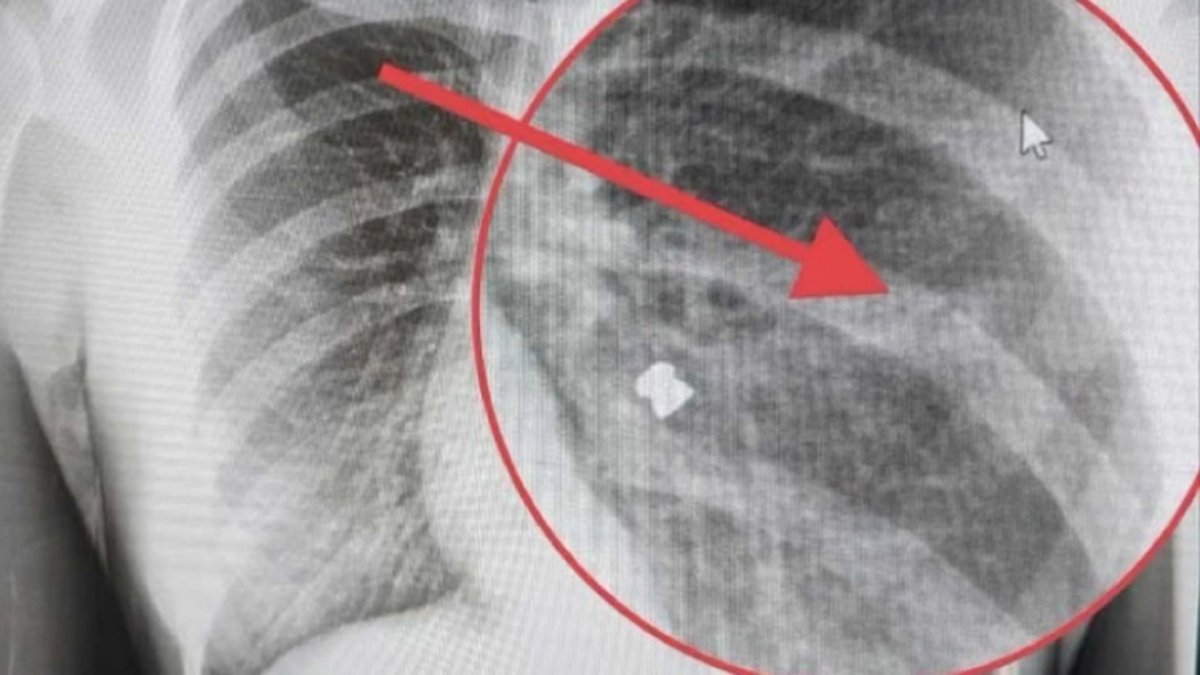 Police Investigates Several Pellet Gun Attacks in San Jose - Vimarsana News