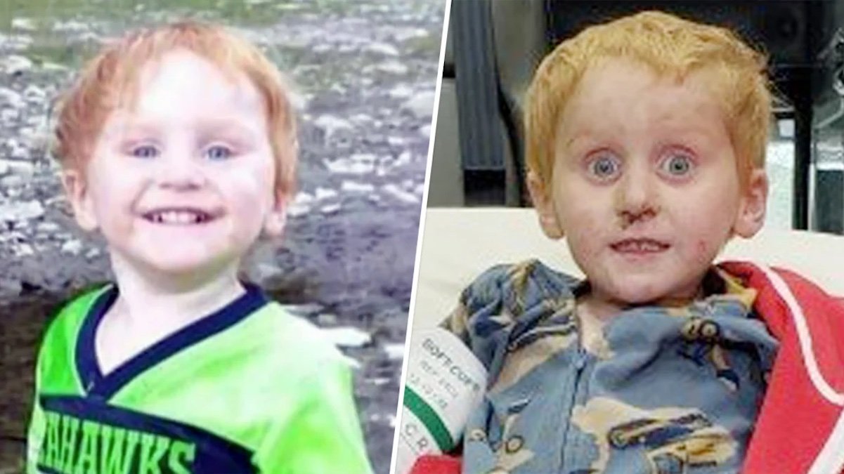 Tale of Survival: How a Lost 3-Year-Old Boy Survived Two Days Alone in Rural Montana – NBC Bay Area - Vimarsana News