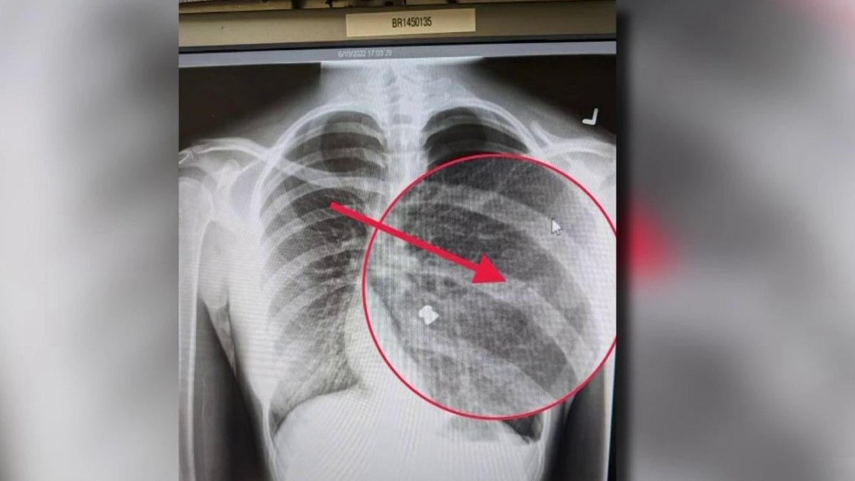 Suspected San Jose Serial Pellet Gun Shooter Arrested Police NBC Bay