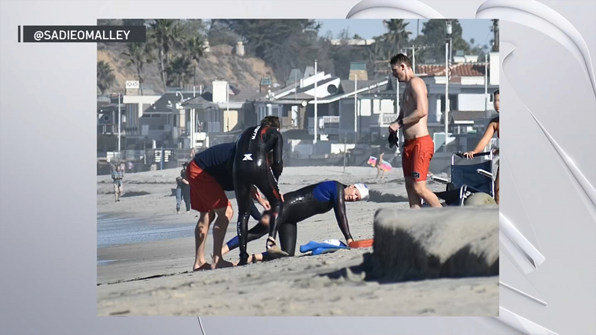 Del Mar Shark Bite Victim Speaks Out – NBC Bay Area - Vimarsana News