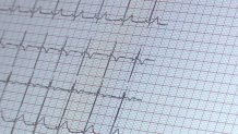“His Life Isn't Ending Here”: South Bay Mom Turns Son's Unexpected Death Into Life-Saving Mission high school heart screening 2 - “His Life Isn't Ending Here”: South Bay Mom Turns Son's Unexpected Death Into Life-Saving Mission