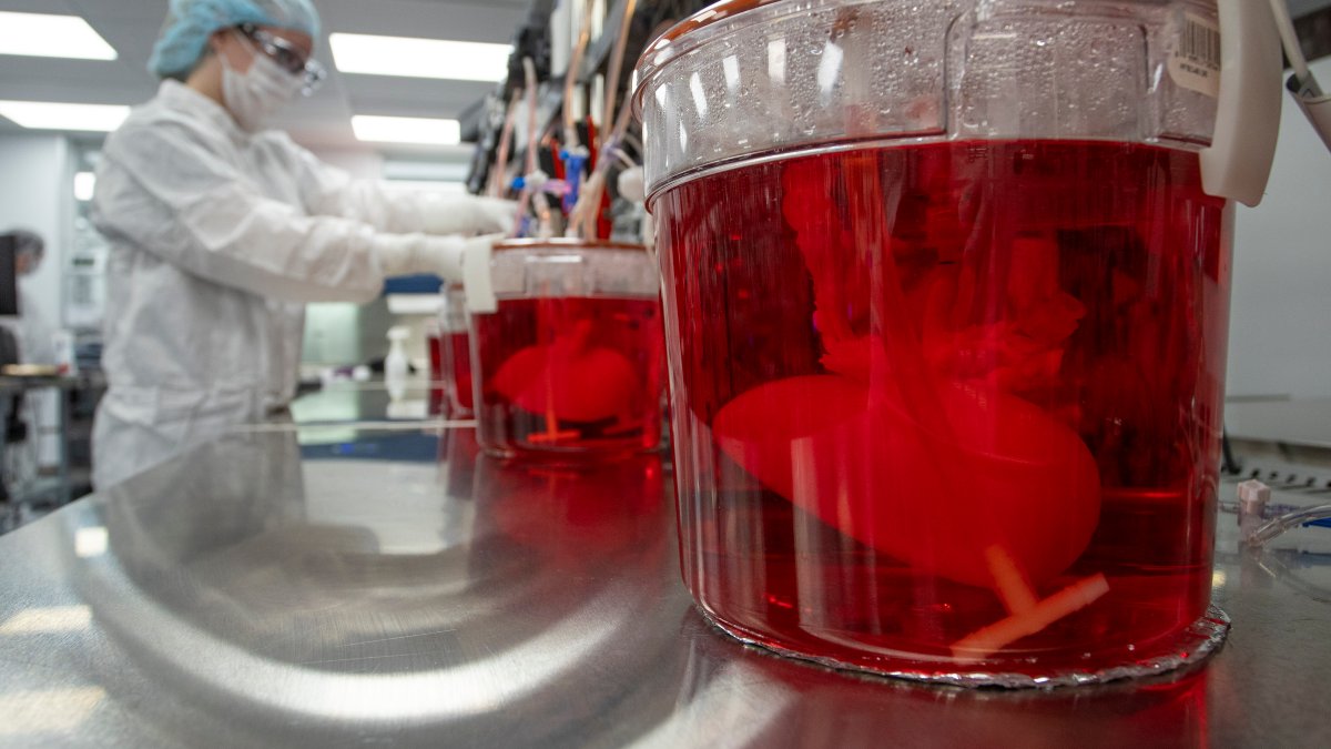 Scientists Seek to Use Pig Livers to Ease Organ Shortage – NBC Bay Area - Vimarsana News