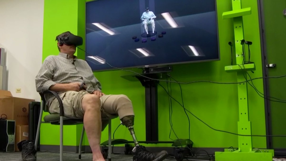 VR Technology Helping Patients With Phantom Limb Pain – NBC Bay Area - Vimarsana News